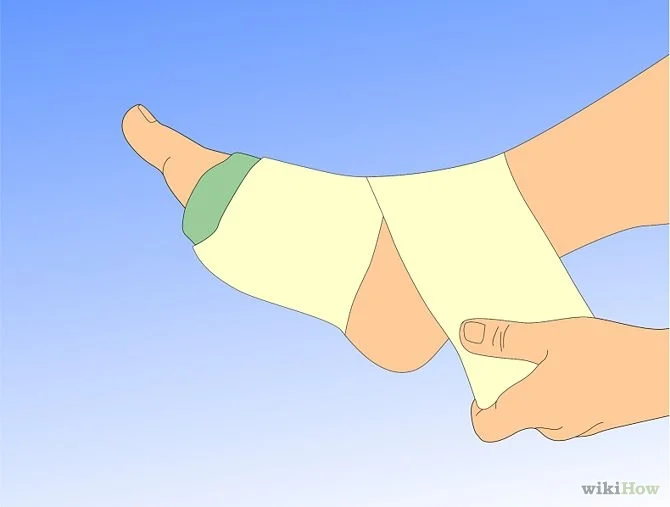 Sea urchin first aid