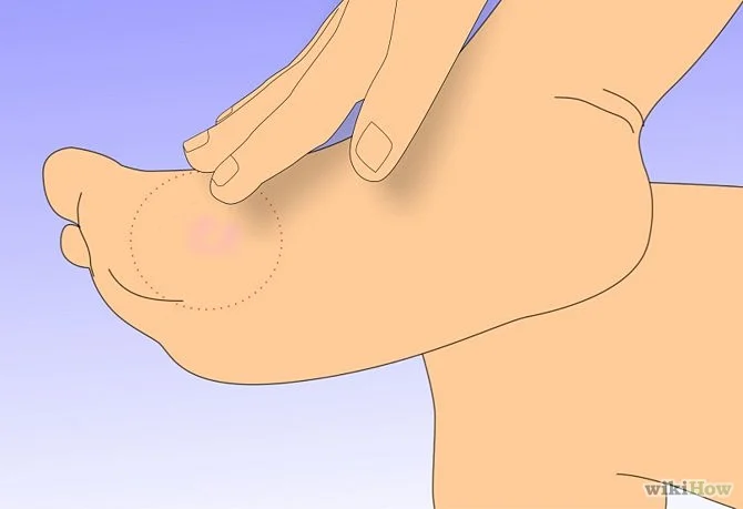 Sea urchin first aid